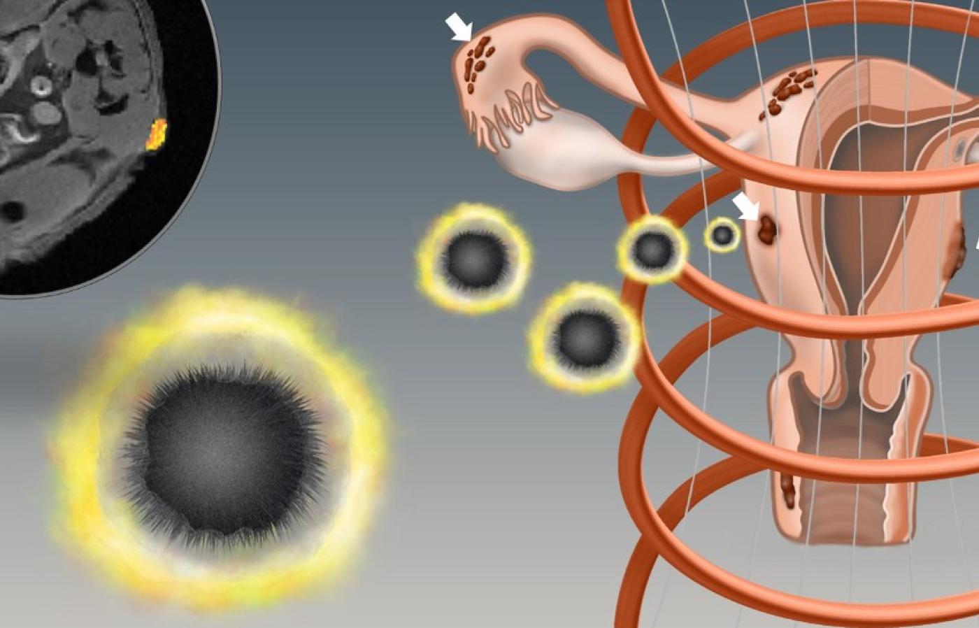 Nanoparticles developed at OSU show promise for locating, removing