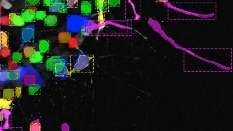 Cancer cells