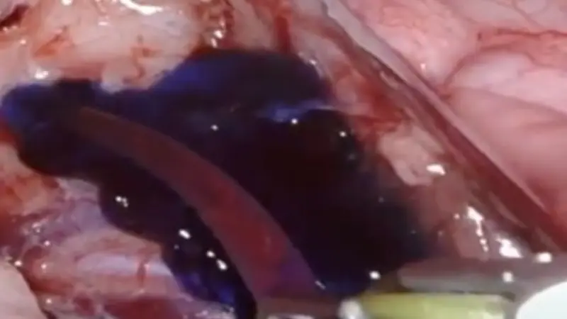 staining nerves with contrast agent