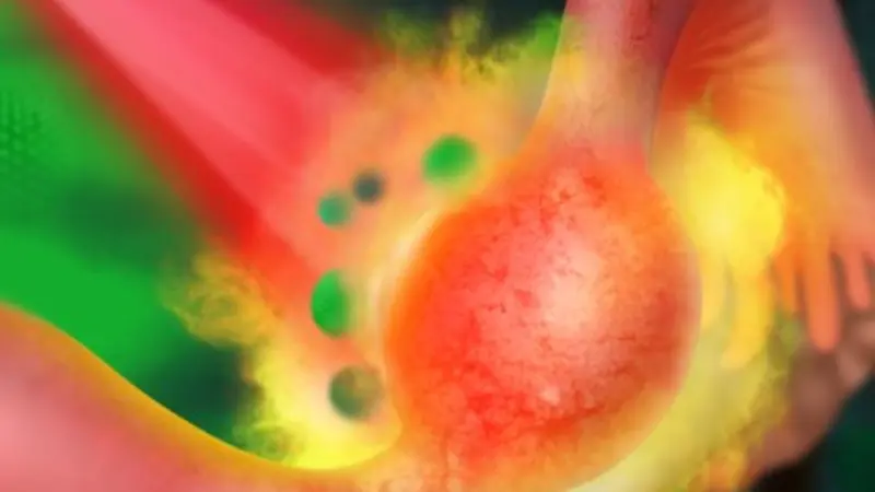 Graphic: Nanomedicine for treating ectopic pregnancy (credit: Parinaz Ghanbari)