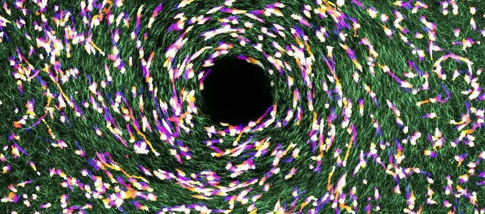 cancer and collagen fibers