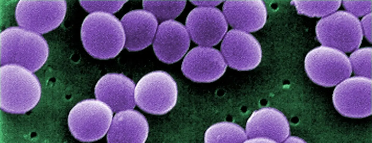 Stahylococcus aureus
