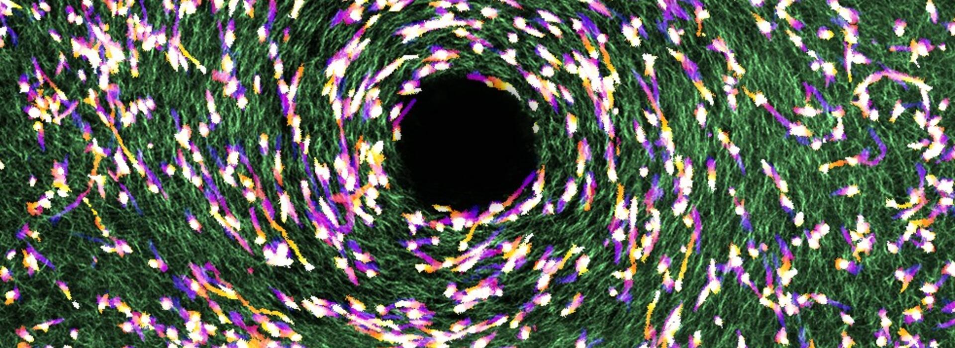 cancer and collagen fibers