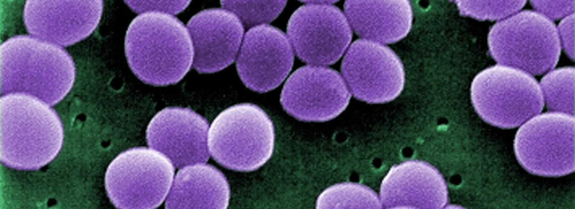 Stahylococcus aureus