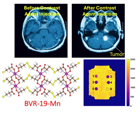 MRI contrast agent graphic