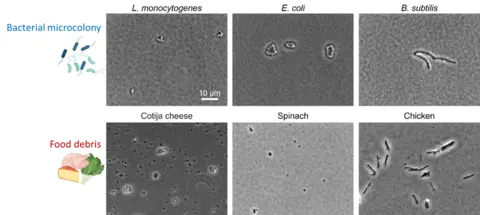 Microscopic images of bacteria and food debris